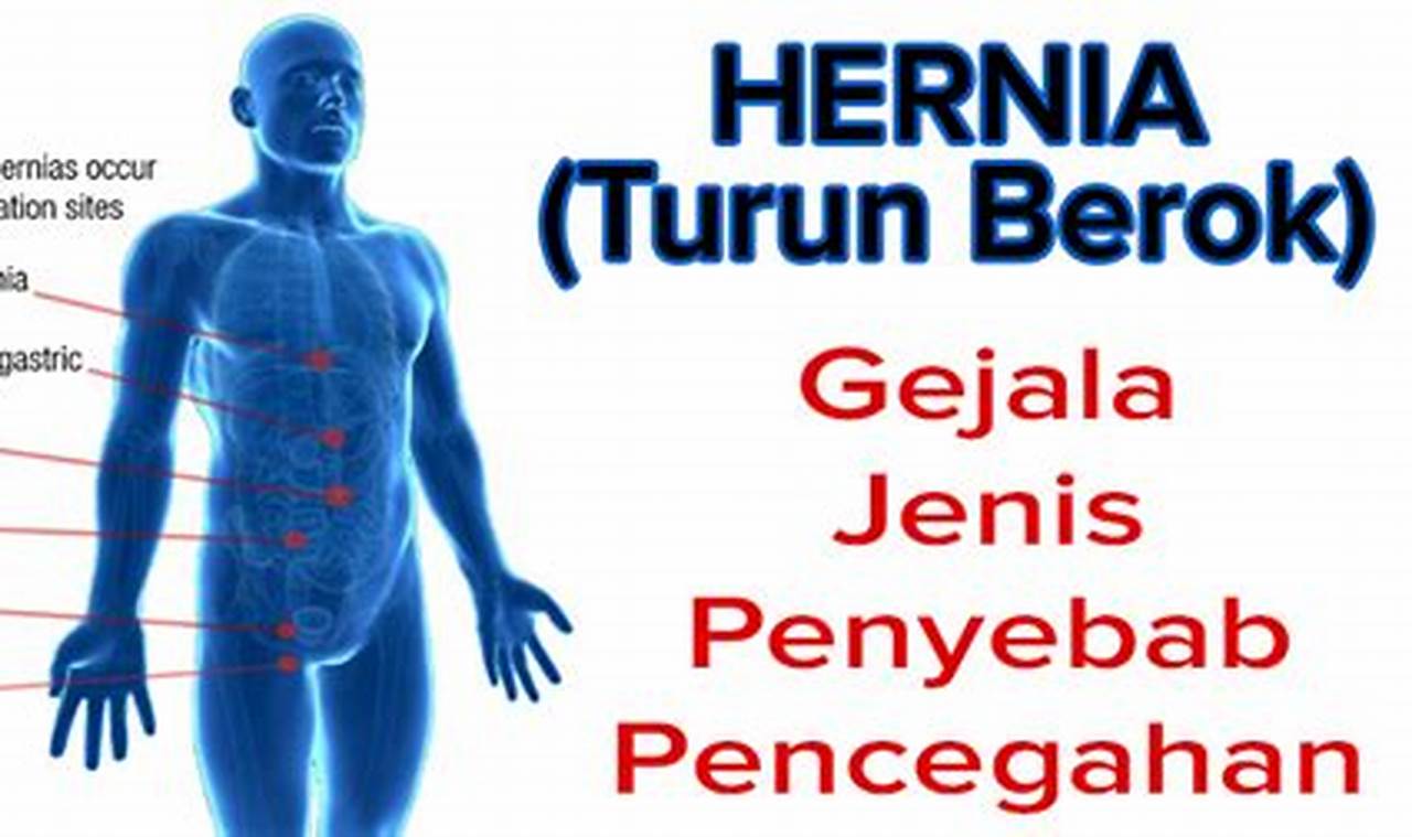 Cara Mengatasi Turun Berok